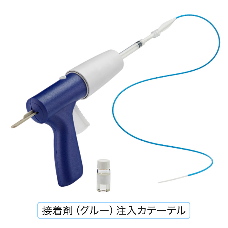 グルー治療（血管内塞栓術）とは